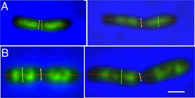 Different Amounts of DNA in Newborn Cells of Escherichia coli Preclude a Role for the Chromosome in Size Control According to the “Adder” Model